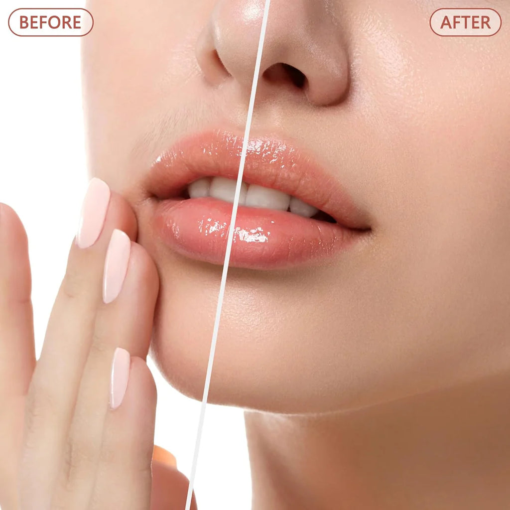 جهاز إزالة شعر الوجه  -face hair remover